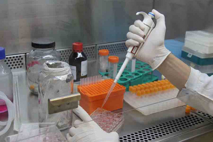 Covid-19: pesquisadores criam teste barato para unidades de saúde - News Rondônia