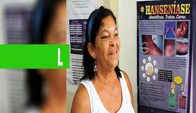 AMBULATÓRIO DE REFERÊNCIA ESTADUAL EM HANSENÍASE REALIZA CERCA DE 400 ATENDIMENTOS POR MÊS - News Rondônia