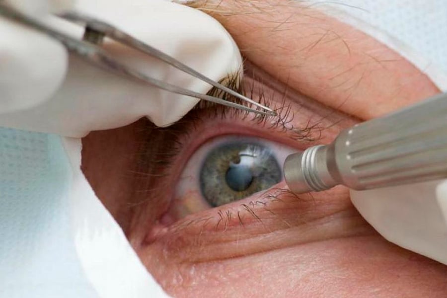 Pandemia causa queda de 27 milhões de procedimentos de saúde em 2020 - News Rondônia