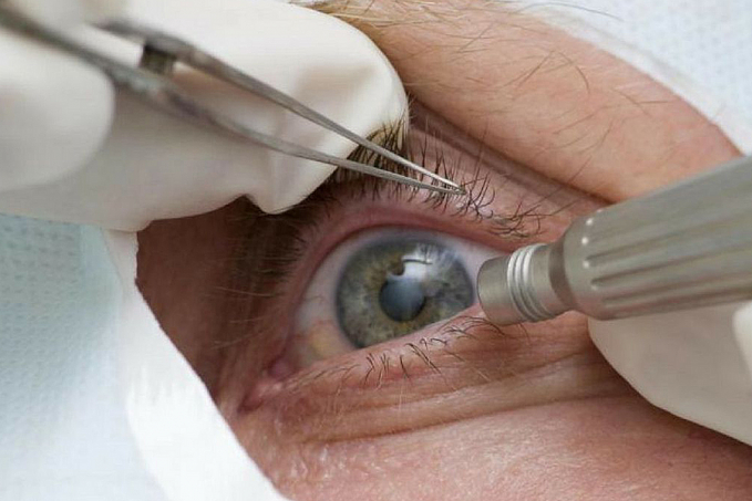 Pandemia causa queda de 27 milhões de procedimentos de saúde em 2020 - News Rondônia