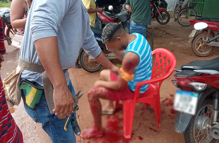 IMAGENS FORTES - Homem não entrega motocicleta e acaba sendo baleado à queima-roupa - News Rondônia
