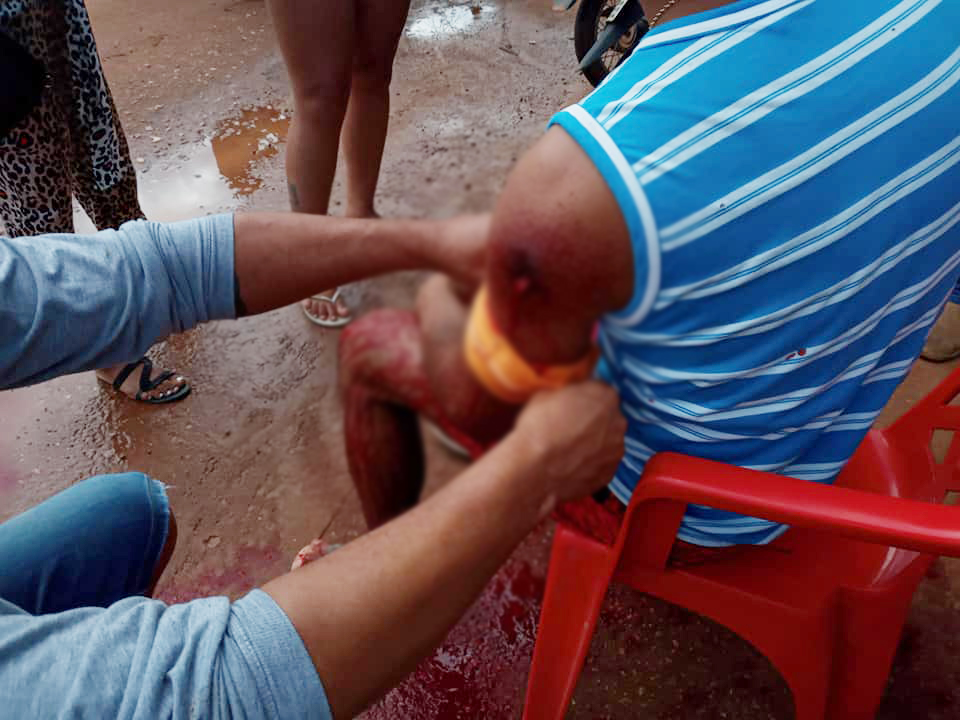 IMAGENS FORTES - Homem não entrega motocicleta e acaba sendo baleado à queima-roupa - News Rondônia