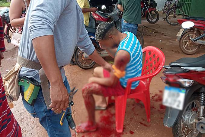 IMAGENS FORTES - Homem não entrega motocicleta e acaba sendo baleado à queima-roupa - News Rondônia