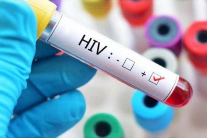 USP entra em rede global de cientistas para encontrar a cura do HIV - News Rondônia