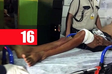 ADOLESCENTE DE 15 ANOS É BALEADO AO SACAR ARMA DURANTE FUGA; COMPARSA DE 16 ANOS FOI APREENDIDO - FOTOS E VÍDEO - News Rondônia