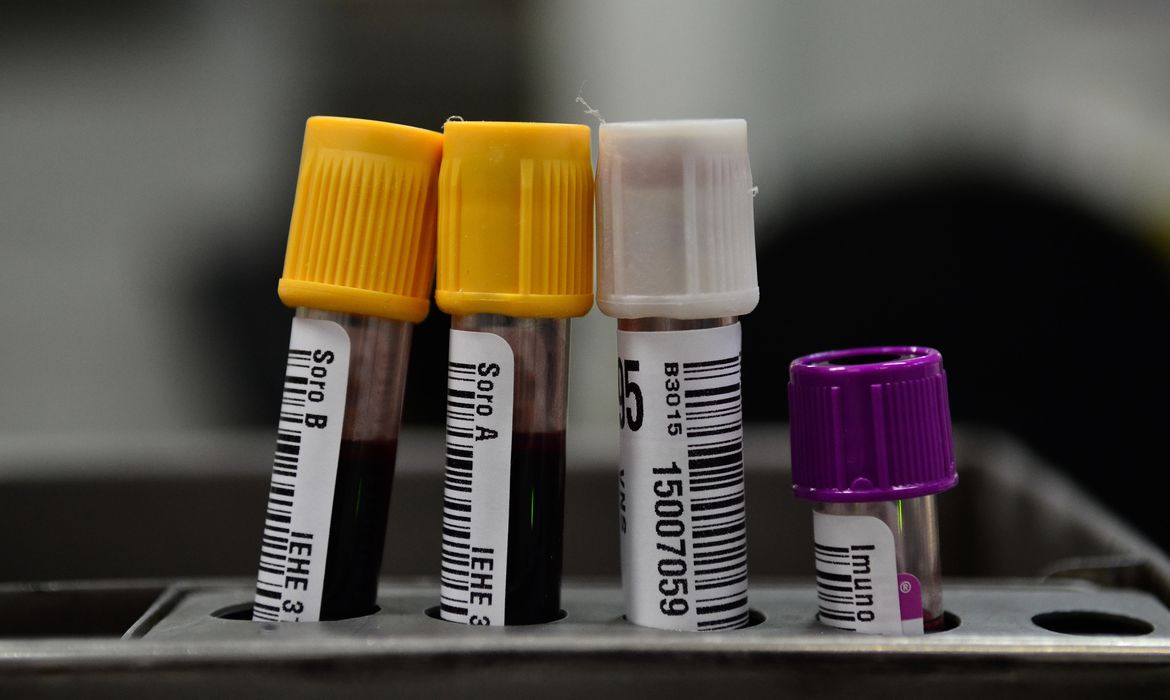 HEMORIO INICIA TESTES COM PLASMA SANGUÍNEO NO TRATAMENTO DE COVID-19 - News Rondônia