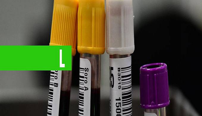 HEMORIO INICIA TESTES COM PLASMA SANGUÍNEO NO TRATAMENTO DE COVID-19 - News Rondônia