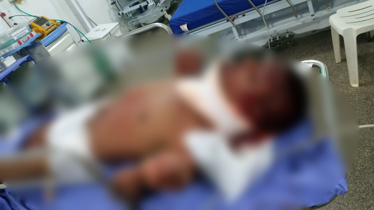 BEBEDEIRA: Adolescente quase mata amigo a tijoladas na cabeça - News Rondônia