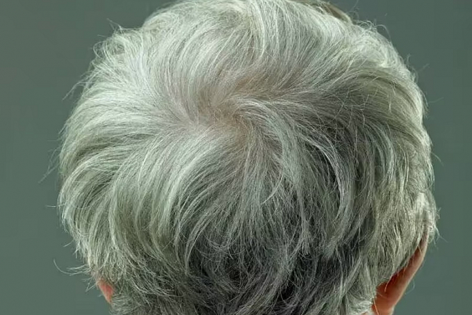 Cabelo branco é reversível, descobrem cientistas dos Estados Unidos - News Rondônia