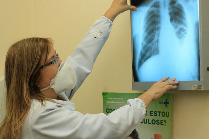 RJ, Acre e Amazonas lideram ranking de mortes por tuberculose no país - News Rondônia