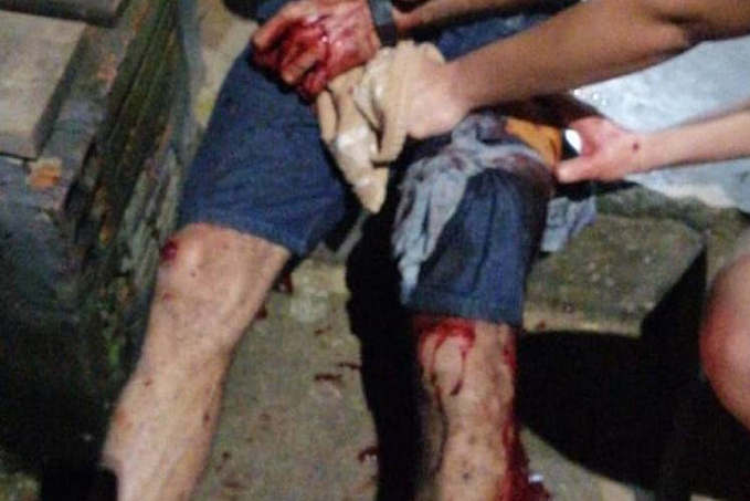 Inconformado com namoro da ex, rapaz de 23 anos esfaqueia dois e escapa da polícia pulando muros e invadindo casas - News Rondônia