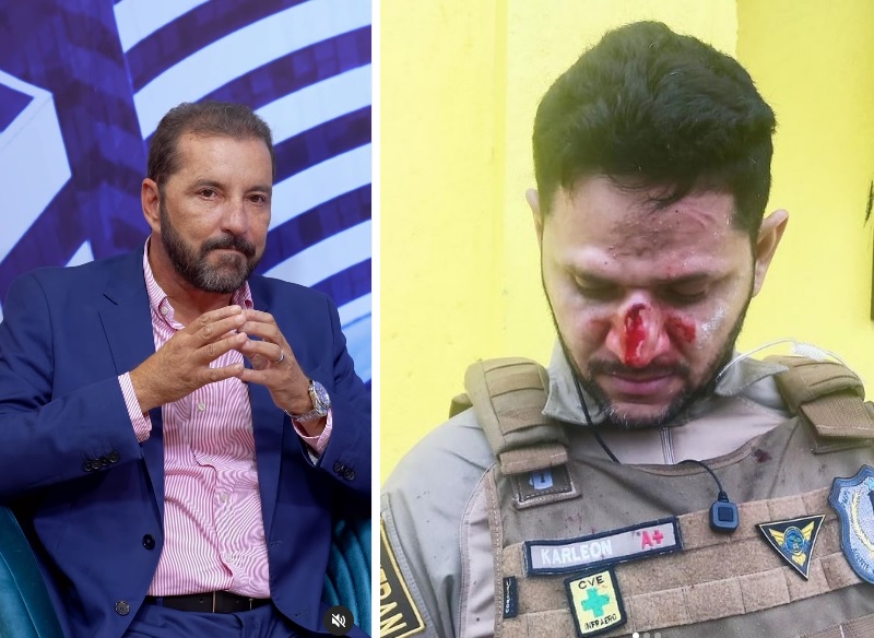 Hildon repudia agressão a agente de trânsito: 'Nosso papel é tornar um ambiente de trabalhos seguro' - News Rondônia