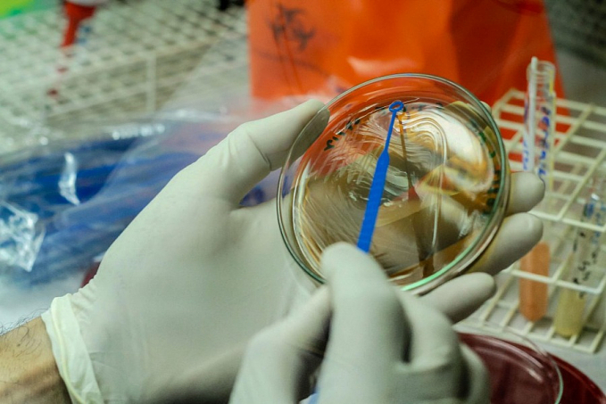 Casos suspeitos de Monkeypox em Rondônia são descartados; resultado é emitido por laboratório referência - News Rondônia