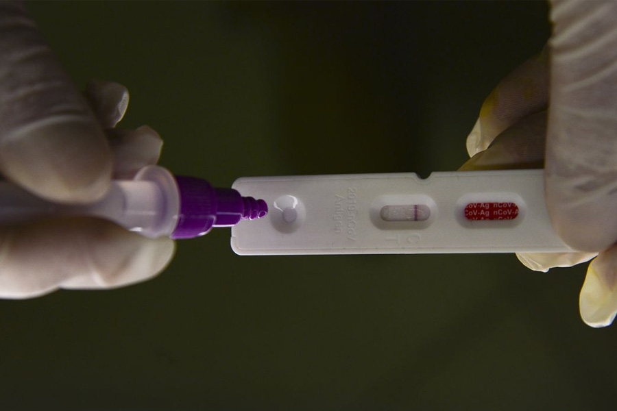 Brasil registra 5.986 novos casos de covid-19 em 24 horas - News Rondônia