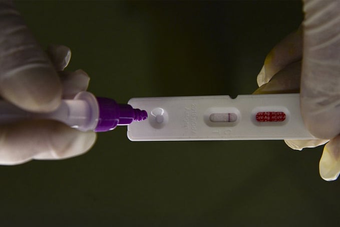 Brasil registra 5.986 novos casos de covid-19 em 24 horas - News Rondônia