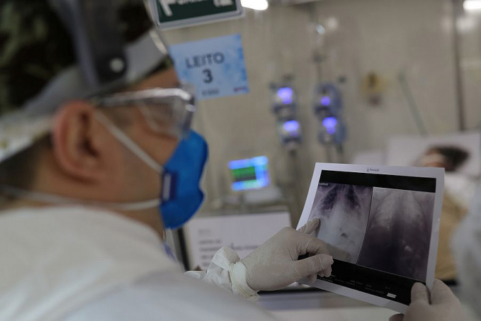 Anvisa flexibiliza uso de máscaras em hospitais - News Rondônia