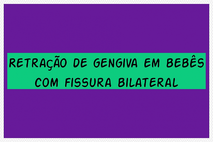 Retração de gengiva em bebês com fissura bilateral - News Rondônia