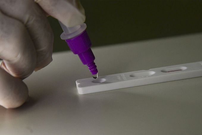Covid-19: Brasil registra 266 óbitos e 77,1 mil casos em 24 horas - News Rondônia