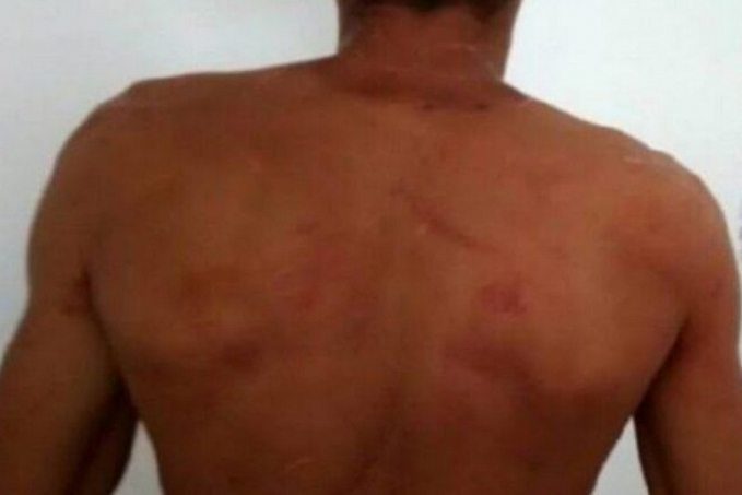 Servidor Público é agredido a capacetadas por cabeleireira em bar - News Rondônia