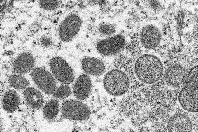 Mundo soma 14 mil casos e cinco mortes de varíola dos macacos, diz OMS - News Rondônia