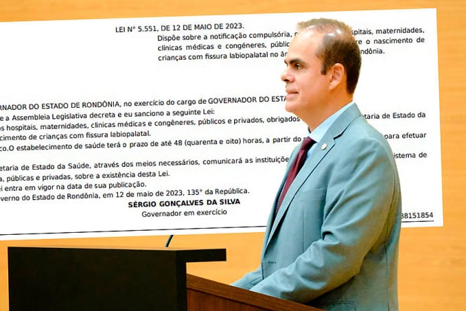 Virou Lei: Maternidades de RO vão ter 48 horas para informar nascimentos de bebês com lábio leporino - News Rondônia