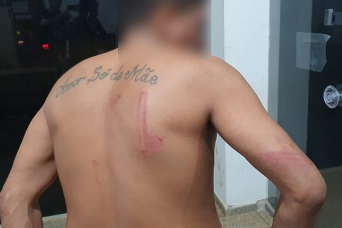 Cabeleireiro é surrado por quatro ladrões que roubaram seus objetos de trabalho - News Rondônia