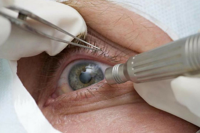 Doença ocular relacionada à idade pode levar à cegueira - News Rondônia