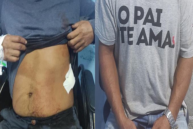 EM FAMÍLIA: Briga de irmãos quase termina em morte a facadas em Porto Velho - News Rondônia