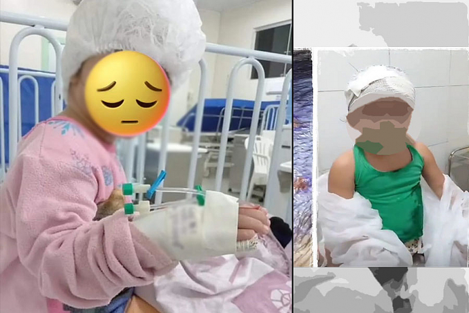 Criança cuidada por babá é socorrida com larvas na cabeça; mãe estava em Rondônia trabalhando - Por Anderson Nascimento - News Rondônia