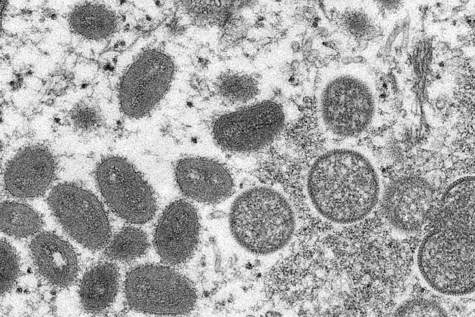 Varíola dos macacos: Brasil tem 978 casos; já são 18 mil no mundo, diz OMS - News Rondônia
