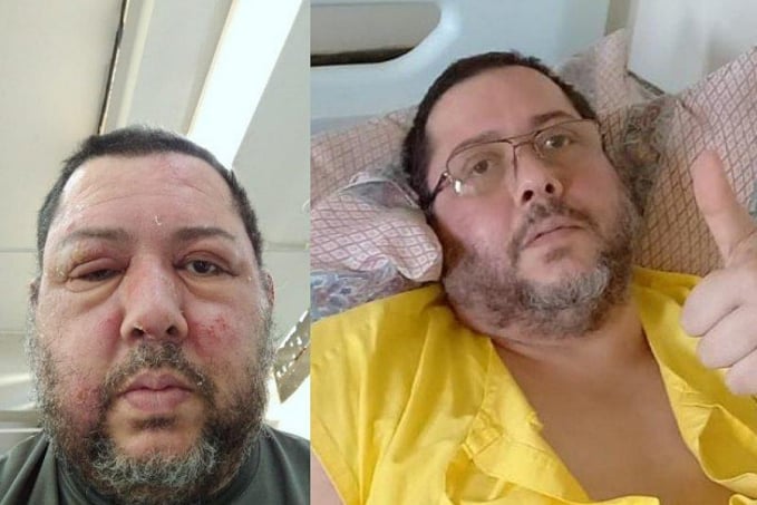 O hospital público salvou minha vida, diz brasiliense paralisado após quadro infeccioso grave - News Rondônia