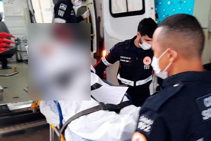 Adolescente de 14 anos é baleada no rosto após reagir assalto na zona leste - News Rondônia