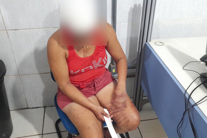 DESNATURADO - Adolescente é apreendido após dar pedrada na cabeça da mãe e esfaquear amigo de infância - News Rondônia