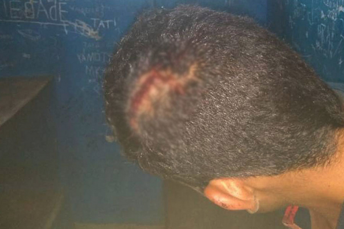 Flagrado furtando fiação em chácara, adolescente ataca dono da propriedade e lava paulada na cabeça - News Rondônia