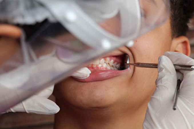 Ministério da Saúde inicia Pesquisa Nacional de Saúde Bucal - News Rondônia