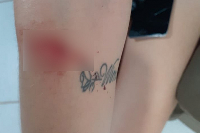 Homem é preso após esfaquear, dar socos e mordidas na esposa que vomitava - News Rondônia