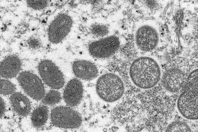 OMS declara varíola dos macacos como emergência de saúde global - News Rondônia