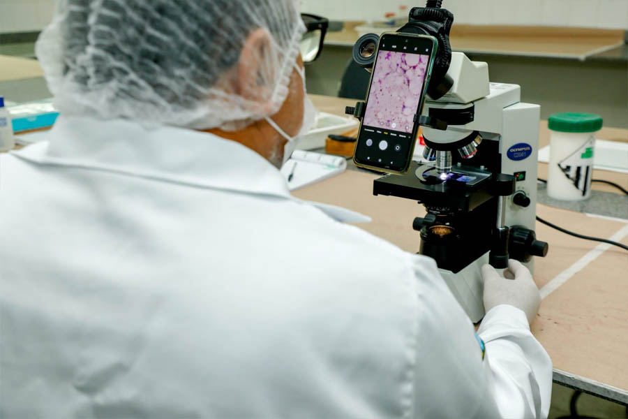 Exames para diagnóstico da Doença de Chagas são realizados no Laboratório Central de Saúde Pública - News Rondônia
