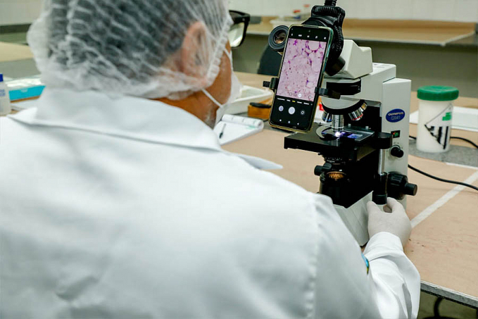 Exames para diagnóstico da Doença de Chagas são realizados no Laboratório Central de Saúde Pública - News Rondônia