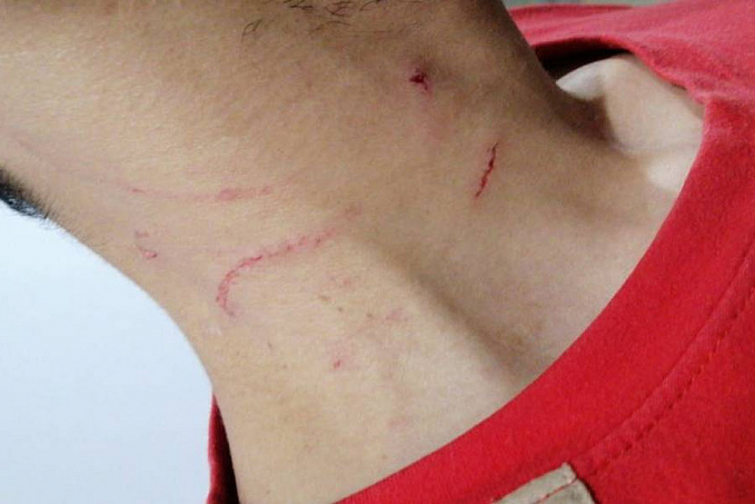 Polícia é acionada e prende mulher que, por não aceitar fim do casamento, havia espancado o ex-marido - News Rondônia