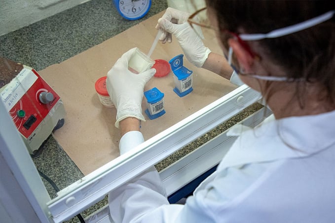 Dia Mundial de Combate à Tuberculose: Preconceito não pode ser obstáculo para buscar tratamento - News Rondônia