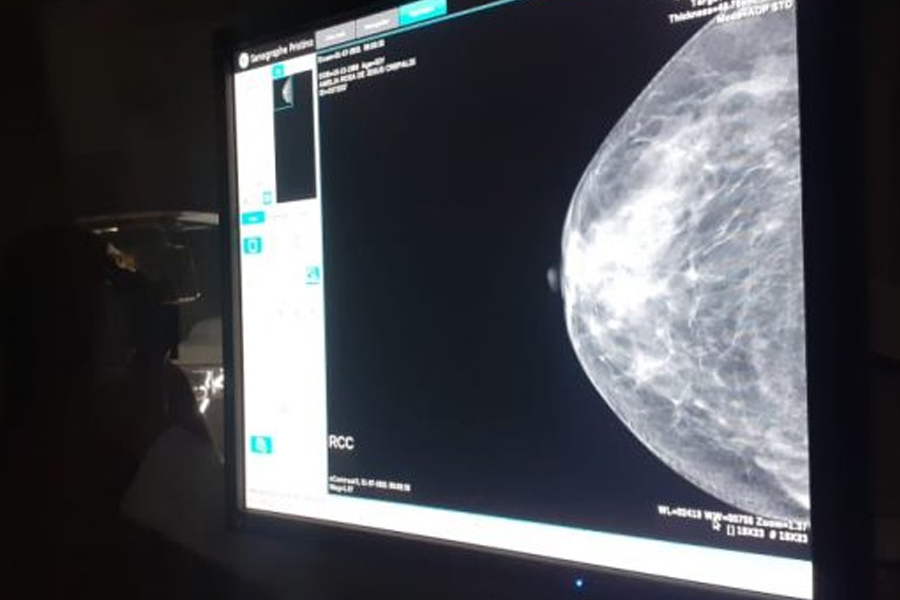 Prefeitura de Jaru realizará cadastro para exames de mamografia no distrito de Tarilândia nos dias 15 e 16 de dezembro - News Rondônia