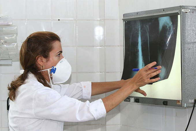 Brasil registra 78 mil novos casos de tuberculose - News Rondônia