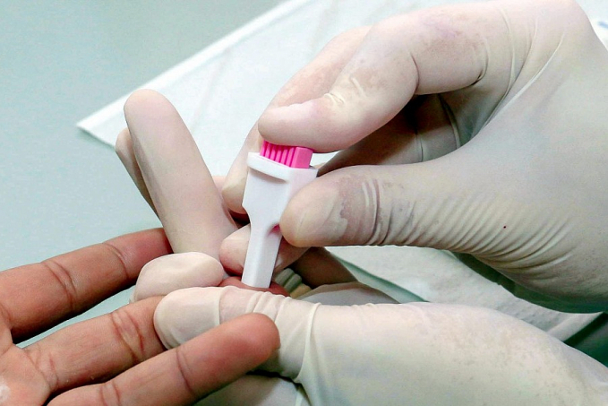 Agevisa intensifica ações com foco na prevenção de infecções sexualmente transmissíveis no Dezembro Vermelho - News Rondônia