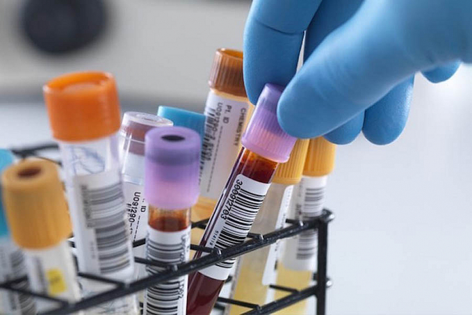 Laboratórios credenciados pela prefeitura de Jaru realizaram mais de 17 mil exames nos meses de dezembro e janeiro - News Rondônia