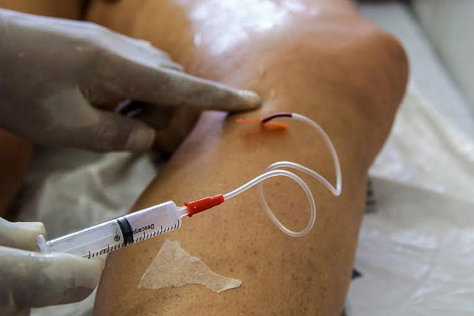 A cada dia, 145 mulheres são internadas para tratar varizes - News Rondônia