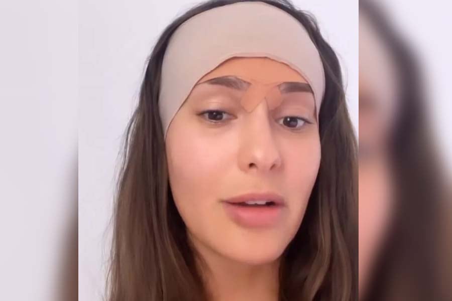 Ex-BBB Thais Braz faz cirurgia para redução de testa; entenda como é o procedimento - News Rondônia