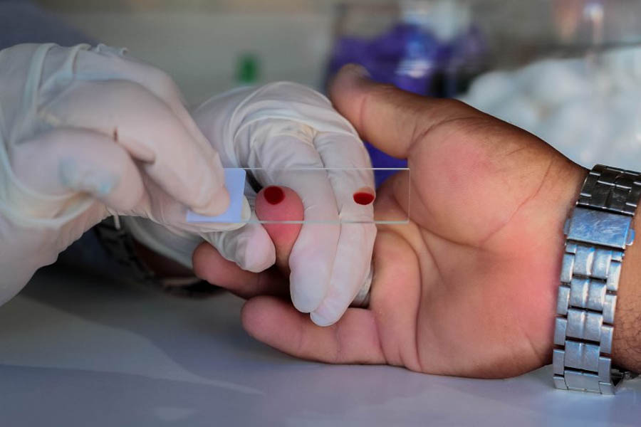 Agevisa destaca ações de promoção e prevenção à saúde da população no ano de 2022 - News Rondônia