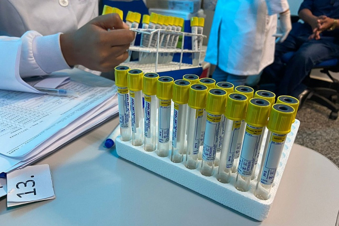 Exame de sangue Antígeno Prostático Específico é oferecido aos servidores públicos durante o Novembro Azul - News Rondônia