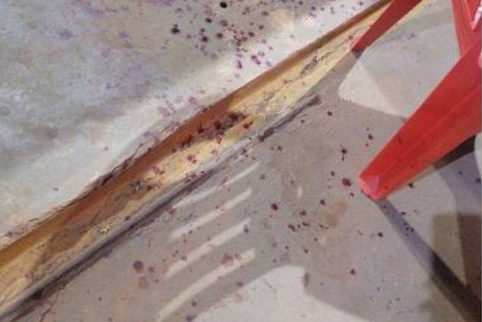 Irritado após a esposa bloqueá-lo no WhatsApp, idoso ataca comerciante com foice e facão, mas também acaba ferido - News Rondônia